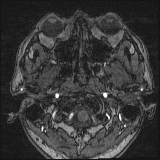 Click on the Serie image to view the images of VILLANUEVA, WILLIAM A.